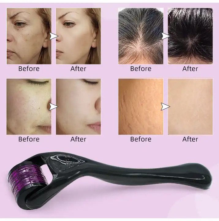 Derma Roller